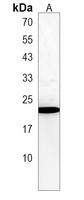 Anti-CT45A3 Antibody