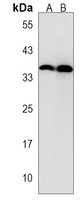 Anti-GPM6B Antibody