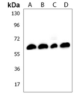 Anti-Collagen 8 alpha 2 Antibody