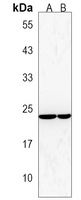 Anti-FRAT2 Antibody