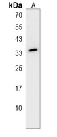 Anti-STARD6 Antibody