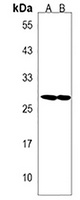 Anti-SPATS1 Antibody