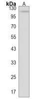 Anti-DIEXF Antibody