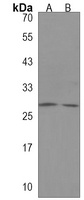 Anti-LCN9 Antibody