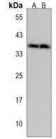 Anti-CELF6 Antibody
