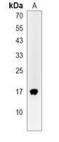 Anti-LSM7 Antibody