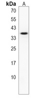 Anti-PRSS21 Antibody