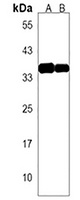 Anti-OR7G1 Antibody