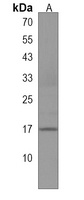 Anti-C1orf115 Antibody