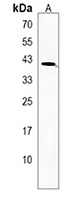 Anti-Siglec 15 Antibody
