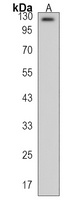 Anti-SCUBE2 Antibody