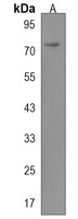 Anti-CPT1C Antibody