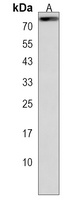 Anti-ZNF648 Antibody