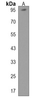 Anti-PTCHD3 Antibody