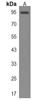 Anti-PTCHD4 Antibody