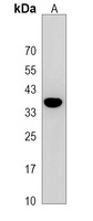 Anti-TMEM150B Antibody