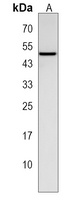 Anti-SLC35F3 Antibody