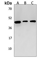 Anti-ANKRD40 Antibody