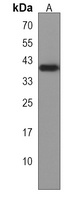 Anti-LRTM2 Antibody