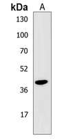 Anti-PSMB11 Antibody