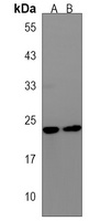 Anti-Phospholipase D6 Antibody