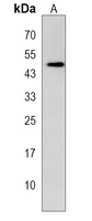 Anti-GPR142 Antibody