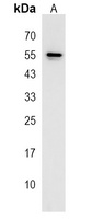 Anti-KRT25 Antibody