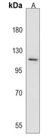 Anti-GIGYF1 Antibody