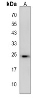 Anti-KHDC3L Antibody