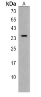 Anti-MOGAT2 Antibody