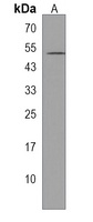 Anti-PPAPDC1A Antibody