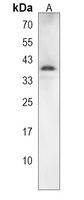 Anti-NXPH4 Antibody