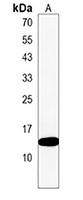 Anti-KRTCAP2 Antibody