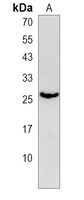 Anti-EMC7 Antibody