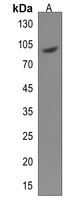 Anti-ACAP1 Antibody