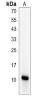 Anti-CGRP-1 Antibody