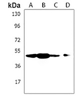 Anti-OTUD3 Antibody