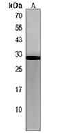 Anti-RILPL2 Antibody