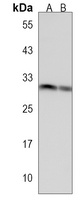 Anti-UNC119B Antibody
