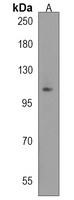 Anti-KIAA1324L Antibody