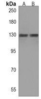 Anti-BCL11B Antibody