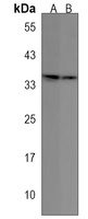 Anti-OR6C4 Antibody