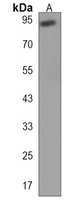 Anti-EFHB Antibody