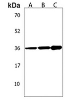 Anti-AMN1 Antibody