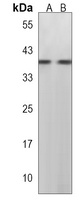 Anti-SLC35G5 Antibody