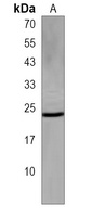 Anti-DPCD Antibody