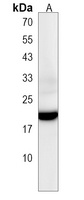 Anti-ORMDL2 Antibody