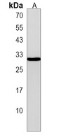 Anti-C11orf73 Antibody