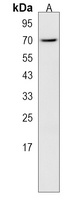 Anti-CLPX Antibody