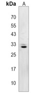 Anti-ZC4H2 Antibody